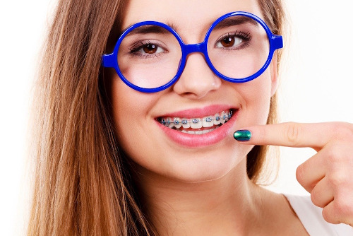 ortodonzia dell'adolescente